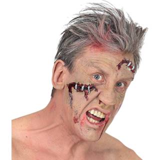 👉 Active Enge kleine open wond met nietjes 8003558097098