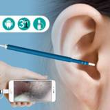 👉 Mini camera 2018 Newest HD Visual Ear Cleaning Tool Otoscope Health Care USB Endoscope for Android