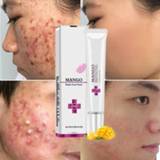 👉 Make-up remover gel Blackhead Acne Treatment Face Cream Repair Oil Control Shrink Pores Scar Whitening Skin Care Cosmetics