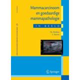 👉 Mammacarcinoom en goedaardige mammapathologie in beeld 9789031362622