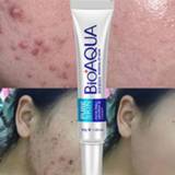 👉 Make-up remover gel BIOAQUA Acne Removal Cream Treatment Anti-Acne Scar Whitening Face Moisturizing Oil Control Skin Care