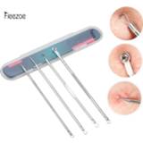👉 Make-up remover Fieezoe 4Pcs/Set Blackhead Acne Needle Pimple Tool Limpieza Facial Comedone Spoon