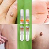 Make-up remover 2 pcs Skin Wart Pen Tag Mole Genital Foot Corn Verruca Liquid care