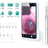 👉 Gyroscoop Digital Ear Otoscope with 5 Inch Screen 3.9mm Camera 2.5D Touch 5.0MP Scope Endoscope 4-Axis Gyroscop