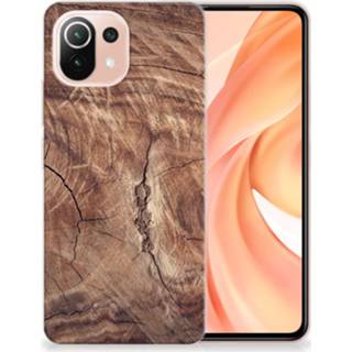 👉 Bumper hoesje Xiaomi Mi 11 Lite Tree Trunk 8720215056310
