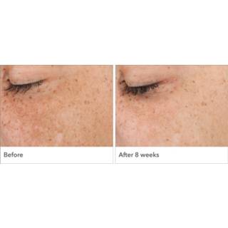 👉 Serum unisex Dr Dennis Gross Skincare Professional Grade IPL Dark Spot Concentrated 30ml