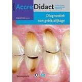 👉 Naslagwerk Diagnostiek van gebitsslijtage. bij de onlinecursus, Lobbezoo, Frank, Paperback 9789089761866