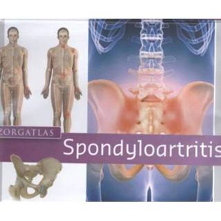 👉 Zorgatlas Spondyloartritis - I.A.A.M. Van Echteld 9789491984440